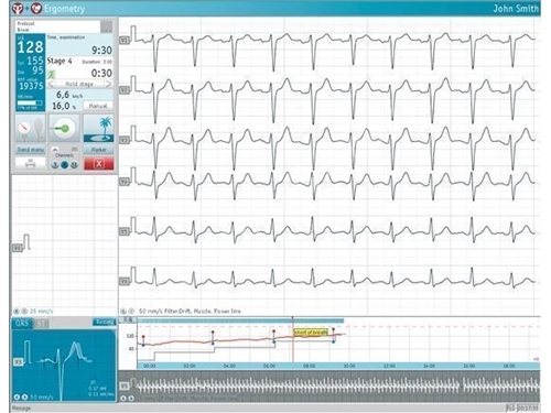 Eforlu Ekg Cihazı 12 Kanal / Medset Flashlight Ergo