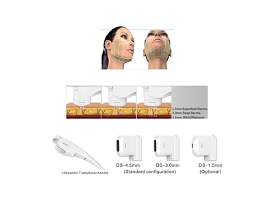 HF 020 (Haute Intensité Focus Ultrason) Dispositif de Soin de la Peau  - 0