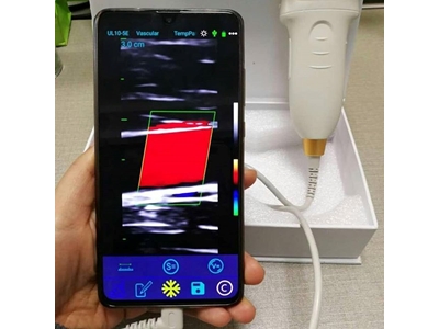 Renkli Portabl Cep Ultrasonografi Cihazı (Kablolu)