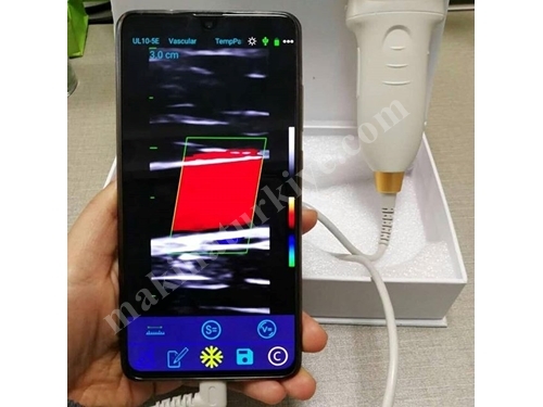 Renkli Portabl Kablolu El Doppleri Lineer Cep Ultrasonografi Cihazı
