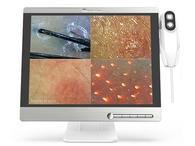 50 X 200 Увеличение Full HD 15 дюймовый экран для анализа кожи и волос - 1