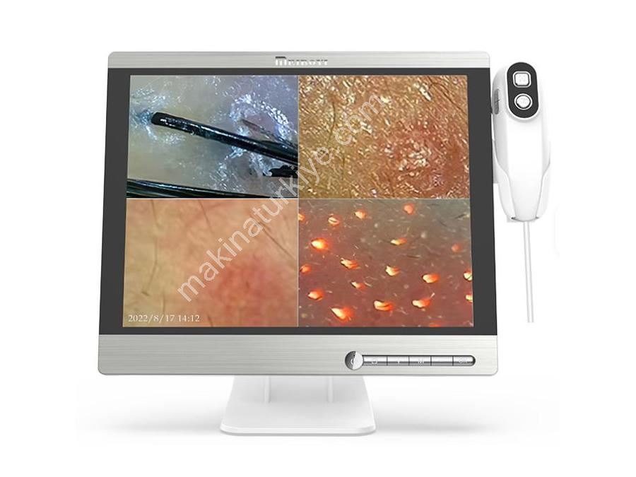 50 X 200 Увеличение Full HD 15 дюймовый экран для анализа кожи и волос