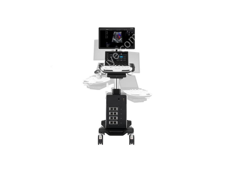 4D Renkli Doppler Ultrasonografi