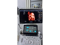 4D Renkli Doppler Ultrasonografi