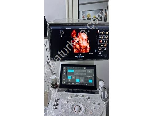 4D Renkli Doppler Ultrasonografi