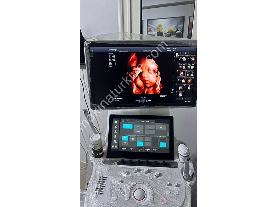4D Renkli Doppler Ultrasonografi