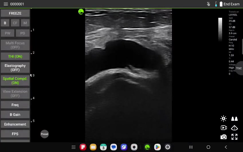 MSK US Tanıtım Videosu